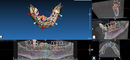 Computerbild: Zahnersatz 3D